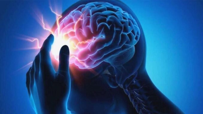 آنوریسم مغزی را می توان در یک هزار نفر از هر 20 نفر مشاهده کرد - PersRail